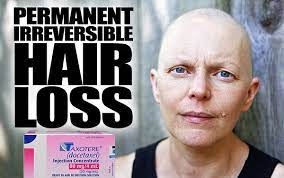 I've tried it before when i was on carbo/taxol but found it. Taxotere Causes Permanent Hair Loss In Women Showard Law Firm