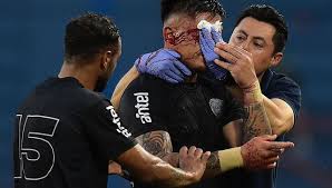 Nacional vs. Cerro Largo: Lesión del Diente, Choque y Llanto de Brasil - Imagen principal del artículo
