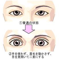 二重にする 似合わない顔や平行二重など二重を解説 男女で違う後悔しない顔つきを