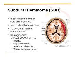 Pinterest Log In Download Brain S Collection By Sandrine Loko 9 Pins Last Updated 4 Years Ago Help Me Pass Nursing School Ask Me Anything Information For Nursing Students And New Resources More Information Endocrine Hormones Endocrine