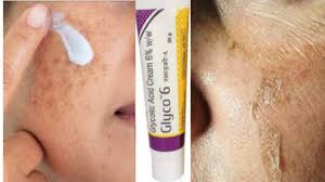 Glyco 6 Cream Glycolic Acid Remove Pigmentation Acne Scars Pimple Marks Youtube