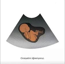 dogacak bebegin cinsiyetini onceden belirlemede kullanilan yontemler