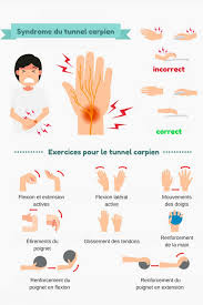Dans le contexte professionnel, les métiers impliquant des travaux manuels répétitifs sont les plus à. Tunnel Carpien Monchiro Ca Votre Chiropraticien Au Quebec On S Occupe De Vous