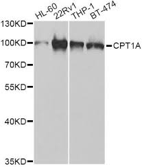 Purified mouse igg, whole molecule. Cpt1a Recombinant Protein Mybiosource