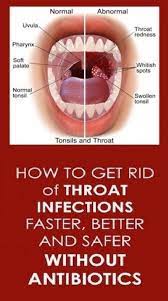 12 Effective Natural Home Remedies To Treat A Strep Throat Infection Painfull Thing But Is Usefull Effec Throat Infection Natural Home Remedies Home Remedies