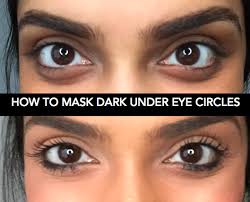 You Won T Believe This Crazy Trick To Get Rid Of Dark Circles Concealer For Dark Circles Undereye Circles Covering Dark Circles