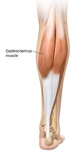Tendinitis is inflammation or irritation of a tendon — the thick fibrous cords that attach muscle to bone. Understanding Gastrocnemius Muscle Tear Saint Luke S Health System