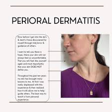 Has your skin ever made you feel so low? From both a physical and emotional  standpoint? You are not alone. 🫶🏼 I want to talk about my personal  experience of having Perioral/Periorificial