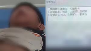 太狠毒！福建初中生遭霸凌下体被火烧伤肋骨骨折| 下体烧伤| 校园霸凌| 福建龙岩| 新唐人电视台