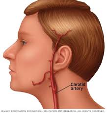 At the lower neck the two common carotid arteries are separated from each other by a very narrow interval which contains the trachea; Atlantic Vein Vascular Associates Pllc Carotid Disease