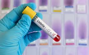 Discover 10 common listeria symptoms at 10faq health and stay better informed to make 10 listeria symptoms. What Is Listeria Symptoms Risk To Pregnancy And How To Avoid Infection Mirror Online