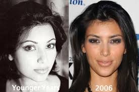 Pin Di Plastic Surgery Before After
