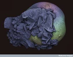Kidney Stone Kevin Mackenzie University Of Aberdeen Click For Details Http Www Linkalo Mind Blowing Images Extreme Close Up Things Under A Microscope