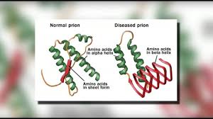 Kuru is a disease which affects the brain. Cjd Creutzfeldt Jakob Disease Mayo Clinic Youtube