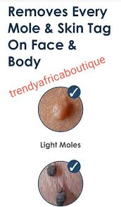 Eurodan Cream - Làn Da Đẹp (Độc Quyền Phân Phối Nexamo, Vinatid, Megaduo  Gel, Skinsiogel, Gluphaxa 500Mg, Gluta Strong White)