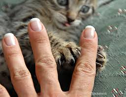 What Can I Catch From My Cat