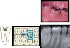 Test Dental Charting Quizlet