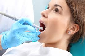 What To Expect After A Root Canal