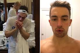 British athlete in Philadelphia: 'if you must have your teeth knocked out,  this is the place'