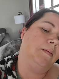 What can I do at home to help my eye issue?