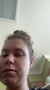 Drawing Removal Update: 6 Days Post-Op Recovery