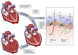 Un mouvement, une respiration, un battement de cœur… la myopathie de duchenne, ou dystrophie musculaire de duchenne, a été décrite pour la première fois en 1860. Myopathie De Duchenne Le Sarcospan Pour Stabiliser La Fonction Cardiaque Sante Blog