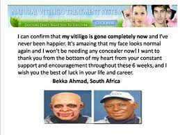 Natural Vitiligo Treatment System Review Video Dailymotion
