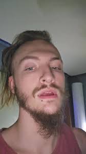 Jacob Simpson Broken Back￼