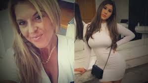 Expériences traumatisantes: deux Québécoises font la promotion de  chirurgies risquées en Colombie