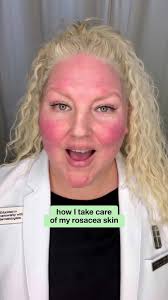 clinique consultant @Sophia Pickle is here to show you how to be gentle  with your rosacea—and give your skin the TLC it deserves. here's her  routine: 💚 redness solutions cleanser 💚 redness solutions ...