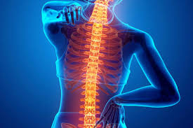 Image result for Ankylosing spondylitis Definition