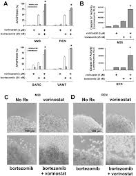 We did not find results for: A Four Mesothelioma Cell Lines M28 Ren Sarc And Vamt Were Grown Download Scientific Diagram