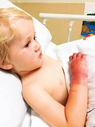 Toddler terror: Trapped in a spa pool