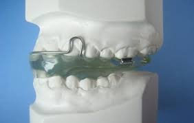 Image Result For Activator Appliance In Orthodontics Orthodontics Dish Soap Appliances