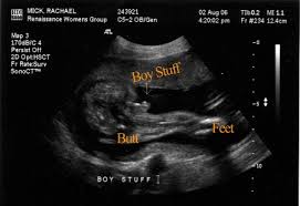 boy vs girl ultrasound difference between