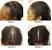 Hair Loss Treatment For Men At Home