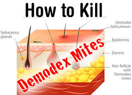 This also contributes to the formation of. How To Kill Demodex Mites Healthy Focus