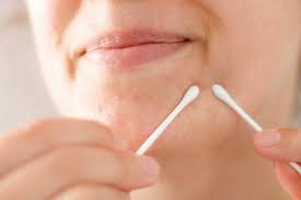 Gegen Pickel Auf Der Nase Frag Mutti