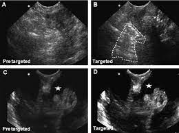You say the doctor says us and the nurse says ct, who writes the orders? The Enhancement In Ultrasound Signal Intensity From Spontaneous Ovarian Download Scientific Diagram