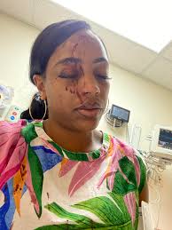 I was in a car accident (1st ever) 🙏 and pray it was the last and only I  was the only one in the car GOD IS GOOD 🙏