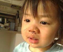 Misalnya, ketika orang tua berdarah paling sering menggunakan kapas, dipasang di bagian hidung, untuk menghentikan. Mimisan Pada Anak Bahayakah Okezone Lifestyle