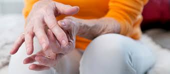 Arthrose in den händen, speziell in den fingern, ist schmerzhaft. Arthrose Finger Handgelenke Symptome Ursachen Polyarthrose Wobenzym