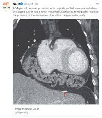 They include a study section, practise section and mock test section. Is A Gastric Emptying Study Helpful In Children Gutsandgrowth