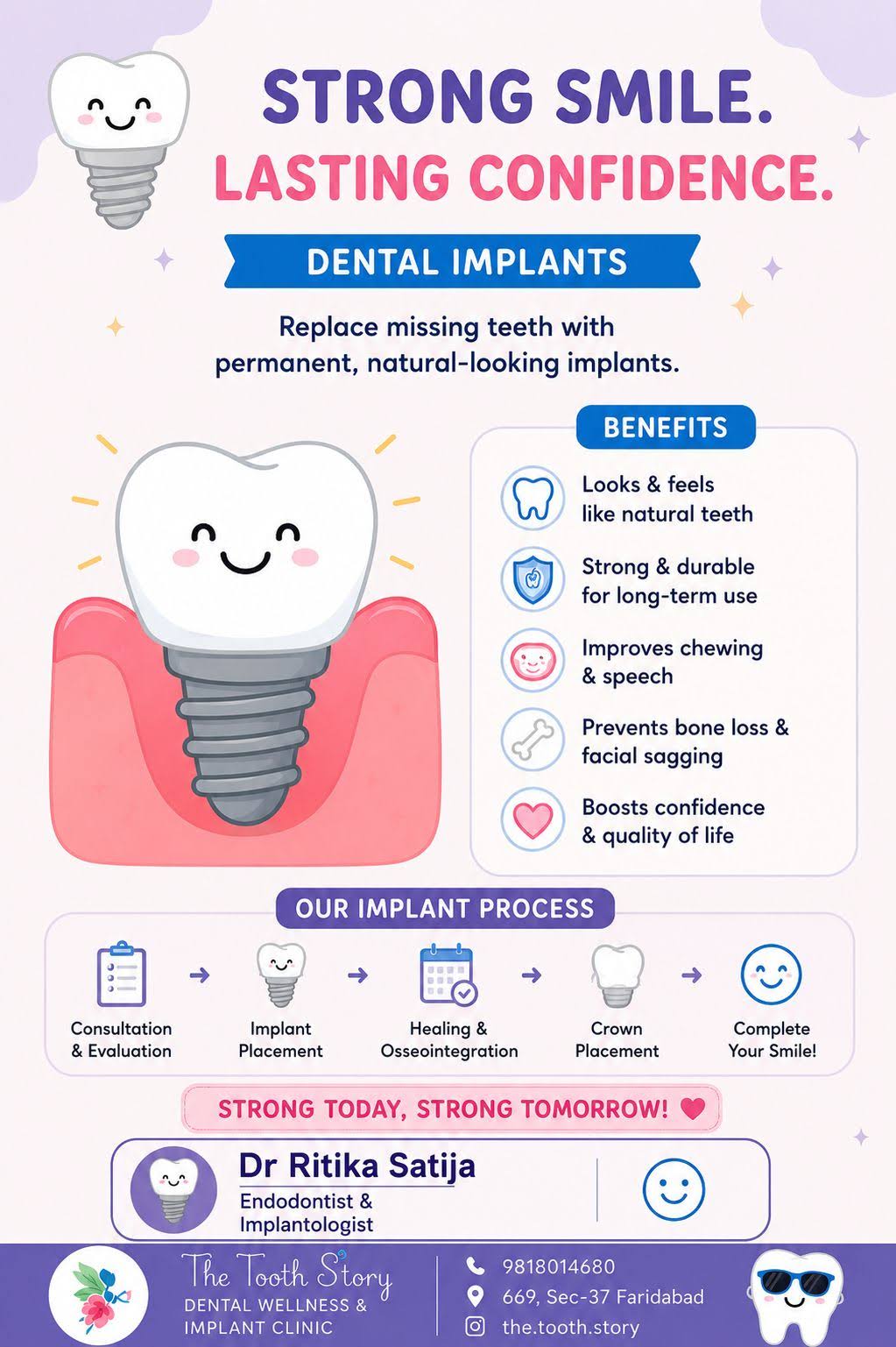 Dental Implants in Faridabad product image