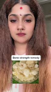 Is Today A Bones Day