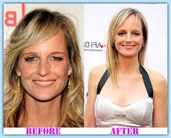There's definitely good reason to believe that helen hunt has done some kind of work, but we can't say for sure. Helen Hunt Plastic Surgery Plastic Surgery Before And After