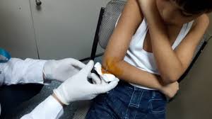 Kirschner Teli Koldan Tel Cikarma Dirsek Kirik Eline Saglik Hastane Saglik Youtube