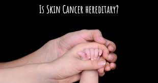 If you have skin cancer, it is important to know which type you have because it affects your treatment options and your outlook (prognosis). Is Skin Cancer Hereditary