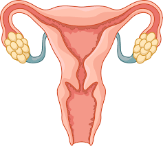 Tokeo la picha la image of endometriosis