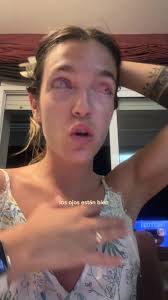 Recuperación de la vista: Reflexiones y experiencias